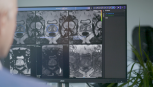 NHS worker looks at results of scan on computer screen