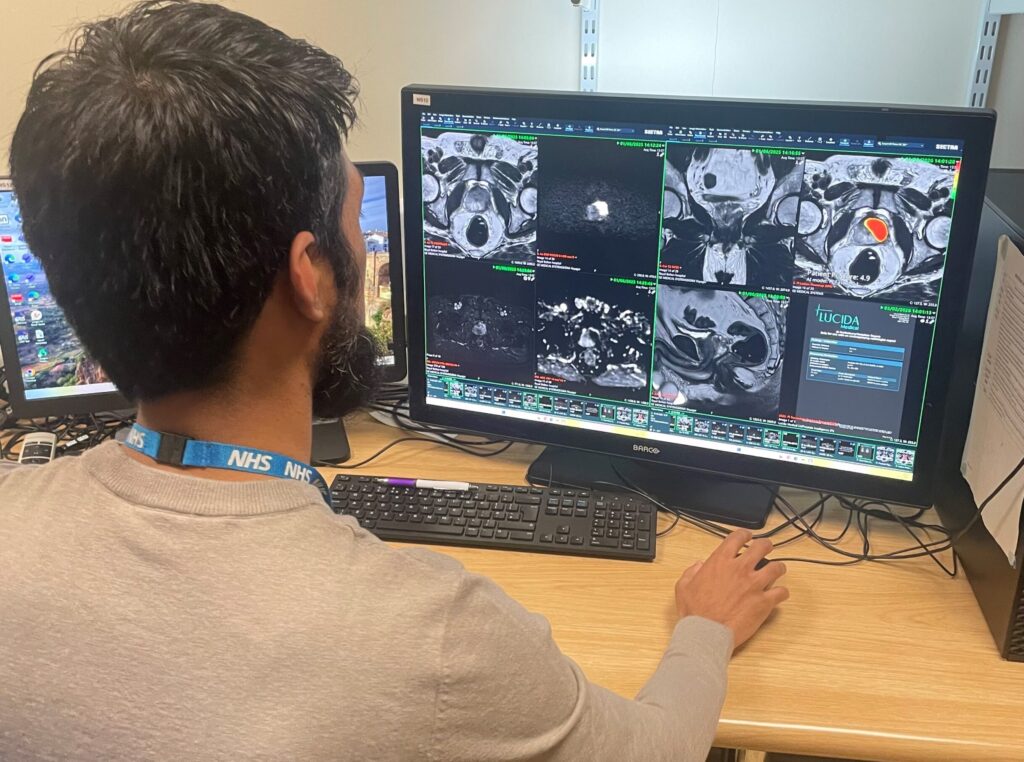 Prostate AI tool work station